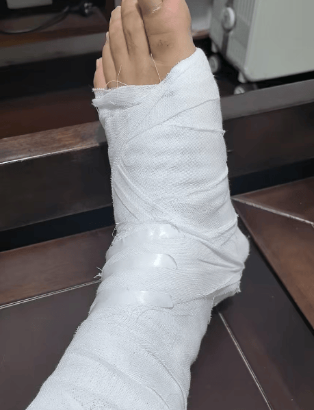 民警在公墓抓獲一嫌疑人<strong></p>
<p>宏鑫機(jī)械設(shè)備有限公司
</strong>，查獲假發(fā)、人臉面具……:宏鑫機(jī)械設(shè)備有限公司
